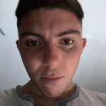 Simo